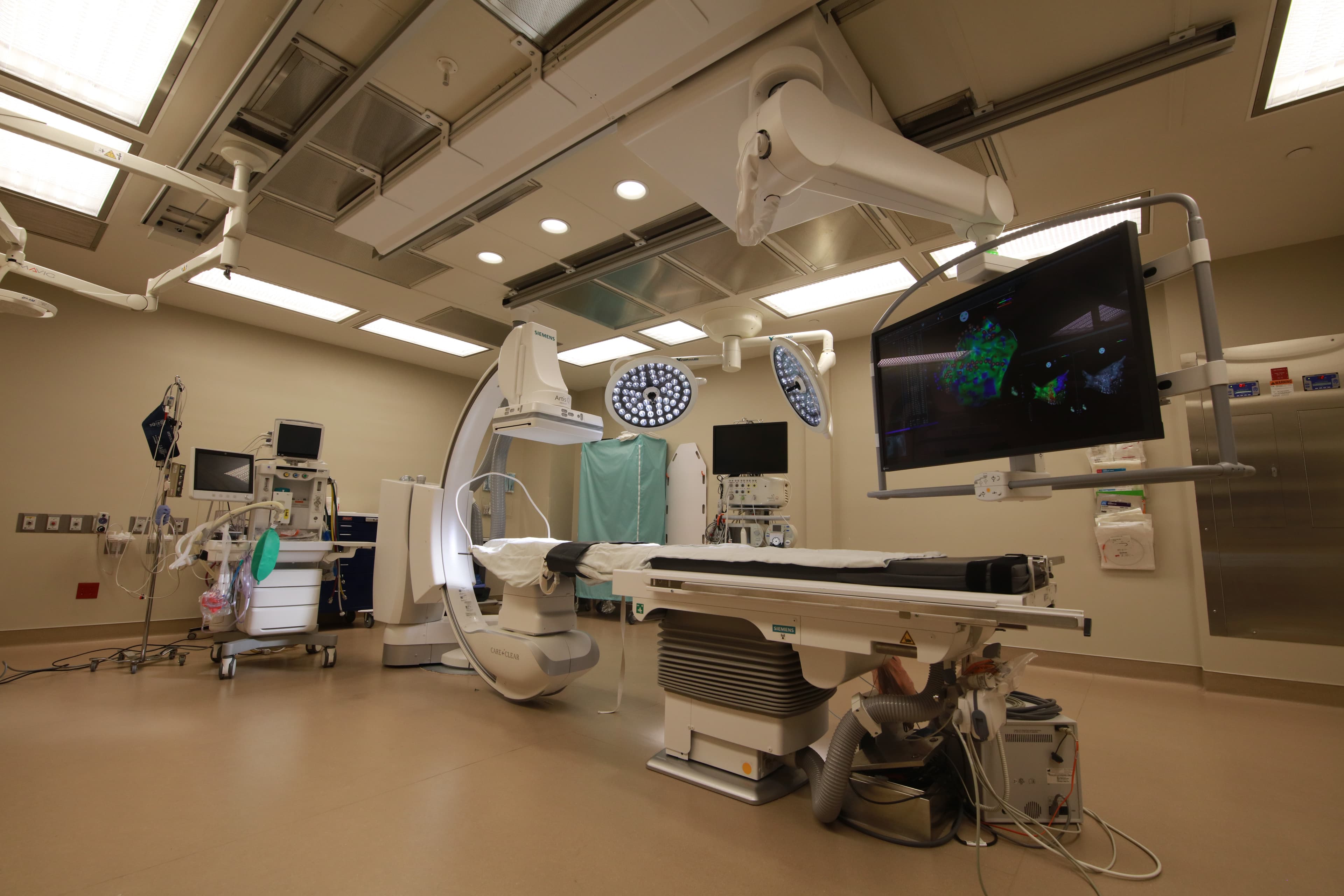 A procedure suite with a fluoroscopic C-arm beside the procedure table, overhead surgical lights, and a large cardiac mapping display.